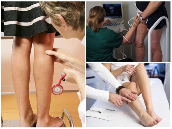 Diagnosis urat variatif