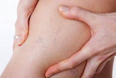 Laku lampah pikeun urat variatif